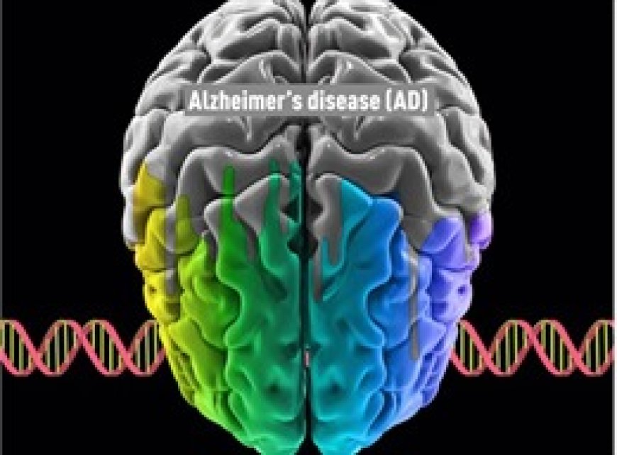 Công bố dữ liệu đầy đủ về thuốc lecanemab điều trị Alzheimer